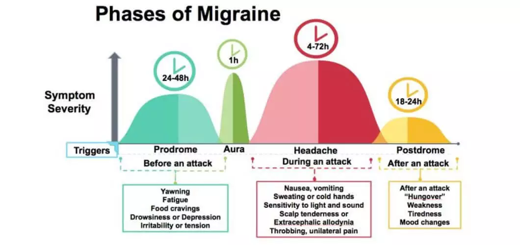 timeline-of-migraine