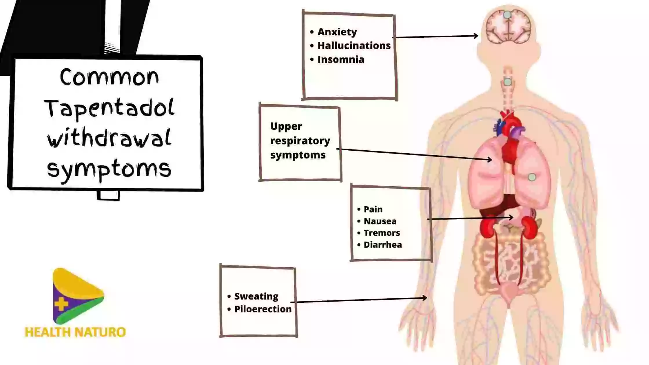 withdrawal symptoms of Tapentadol