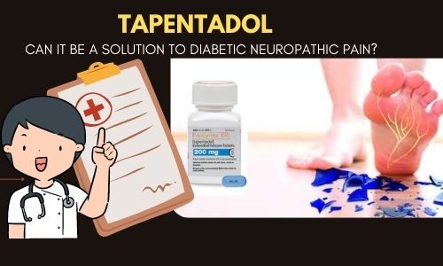 A clinical study on Tapentadol as a diabetic neuropathic pain solution