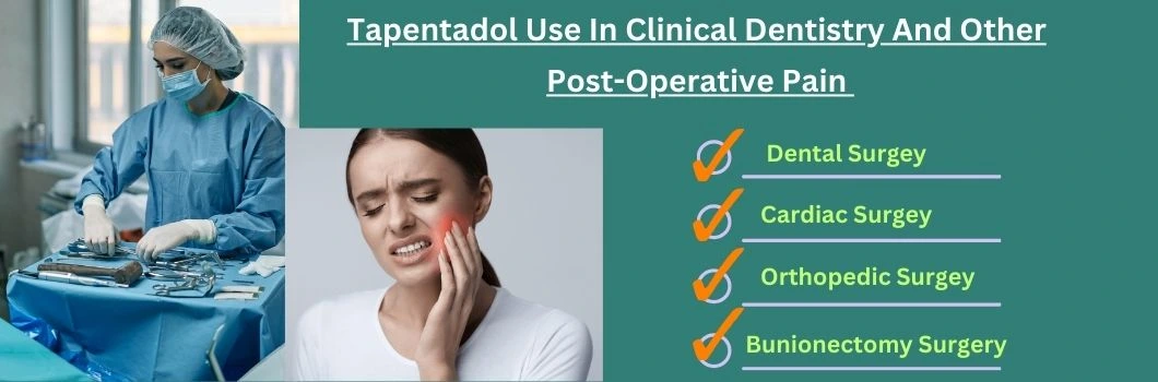 tapentadol-use-in-clinical-dentistry