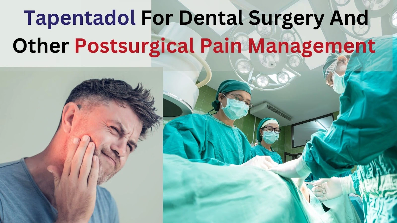 Use Of Tapentadol For Dental Surgery And Other Postsurgical Pain Management